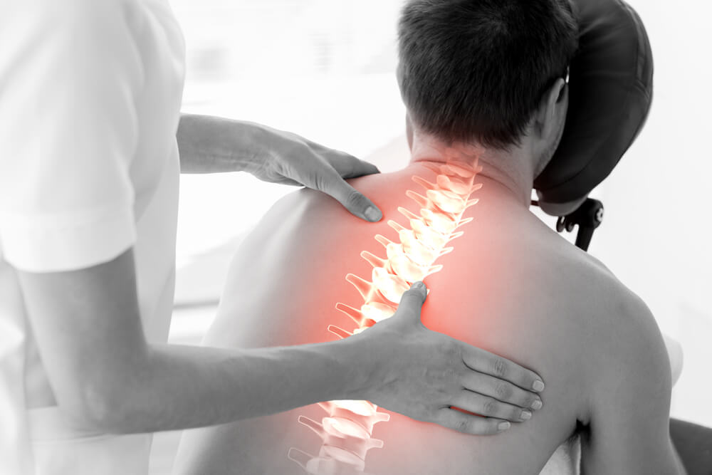 Morbus Scheuermann Ursachen Symptome Und Therapie Rundumgesund De