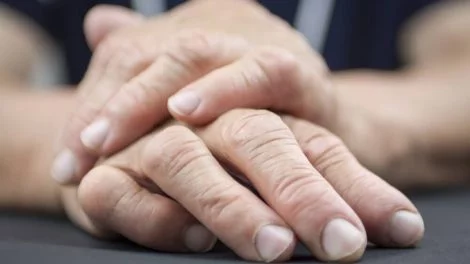 Arthritis