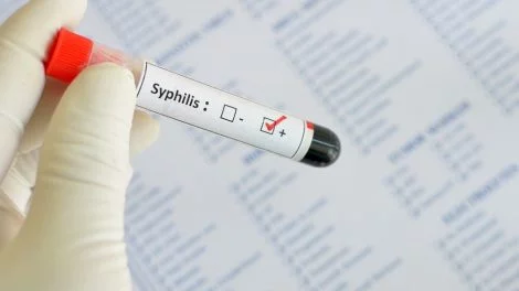 Syphilis