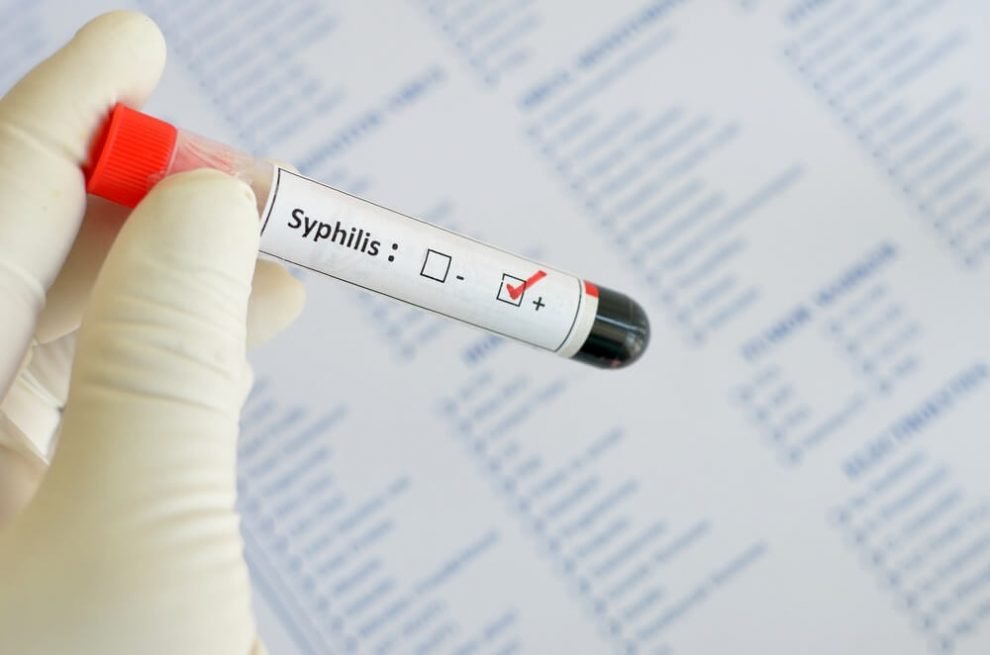 Syphilis