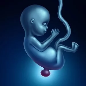 Spina bifida Verwölbung des Rückenmarks