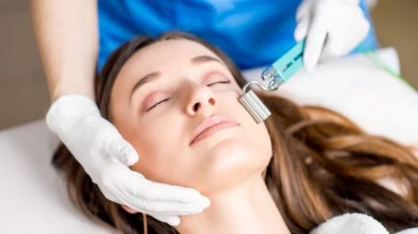 Micro Needling gegen Aknenarben
