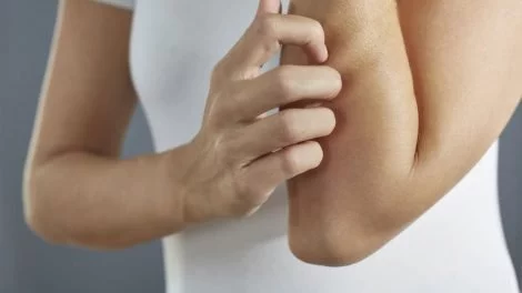 Body Lotion bei empfindlicher Haut