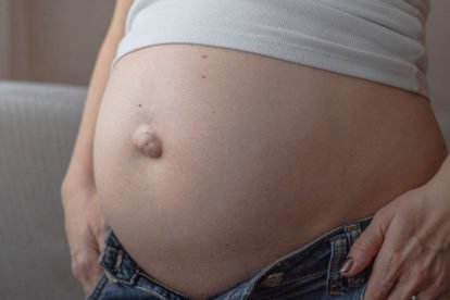 Nabelbruch: Definition, Ursachen und Behandlungsmöglichkeiten im ...